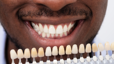 Veneers: Enhancing Oral Wellness Through Custom Solutions
